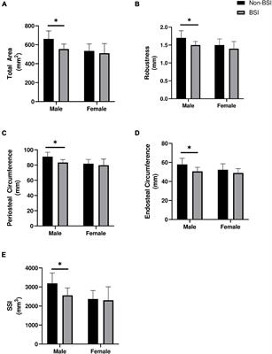 Tibial Bone Geometry Is Associated With Bone Stress Injury During Military Training in Men and Women